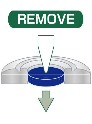 How to remove